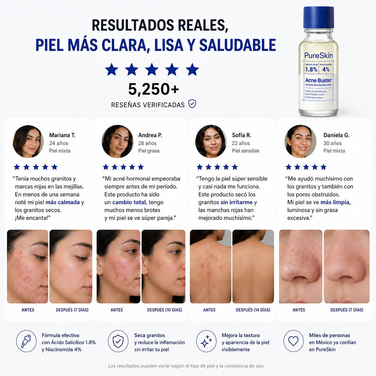 PureSkin™ - Elimina el Acné desde la Primera Aplicación
