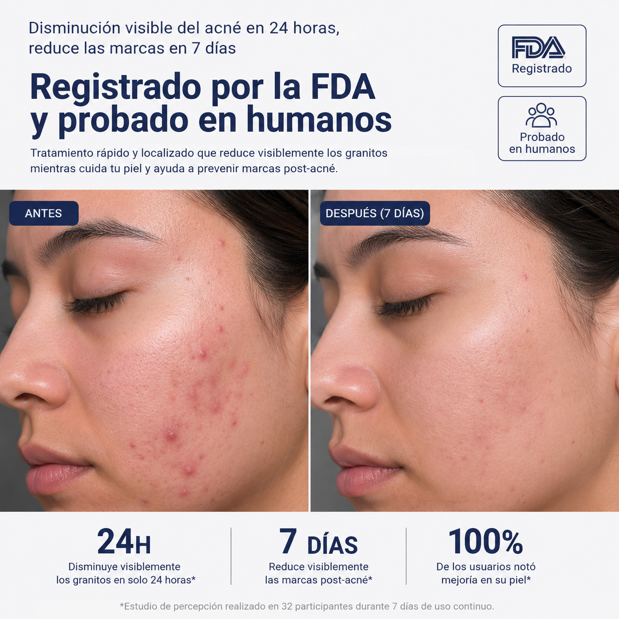 PureSkin™ - Elimina el Acné desde la Primera Aplicación